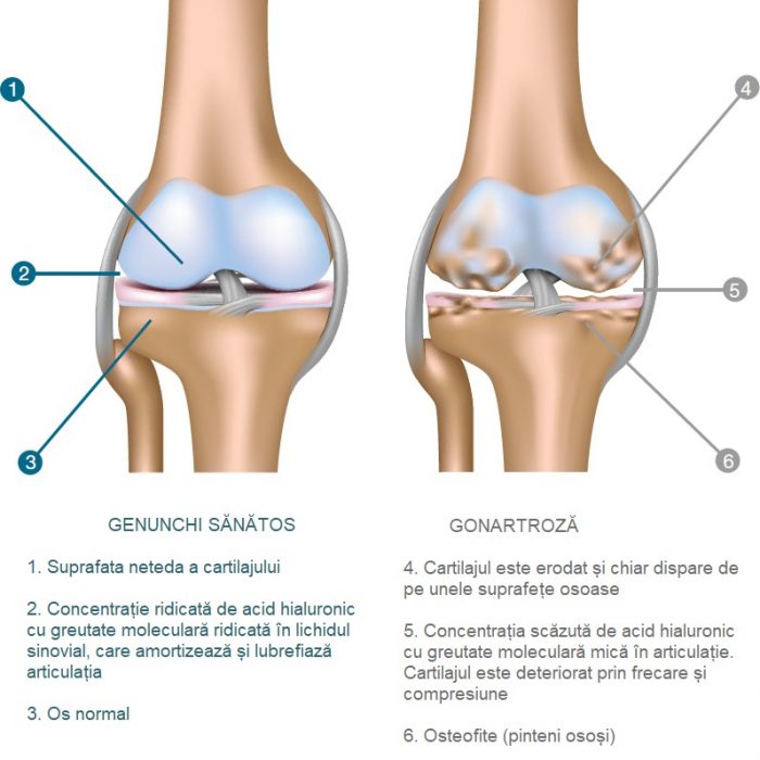 leziuni la genunchi și șold